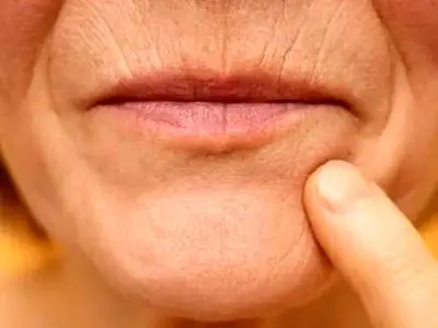 دلایل نازک تر شدن لب ها در دوران پیری