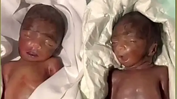 زنده شدن دوقلوی مرده قبل از دفن شدن در چابهار / جنجالی که به پا شد + فیلم 