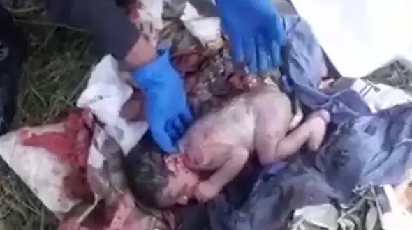 زنده ماندن این نوزاد در میان زباله ها یک معجزه است+ تصاویر

