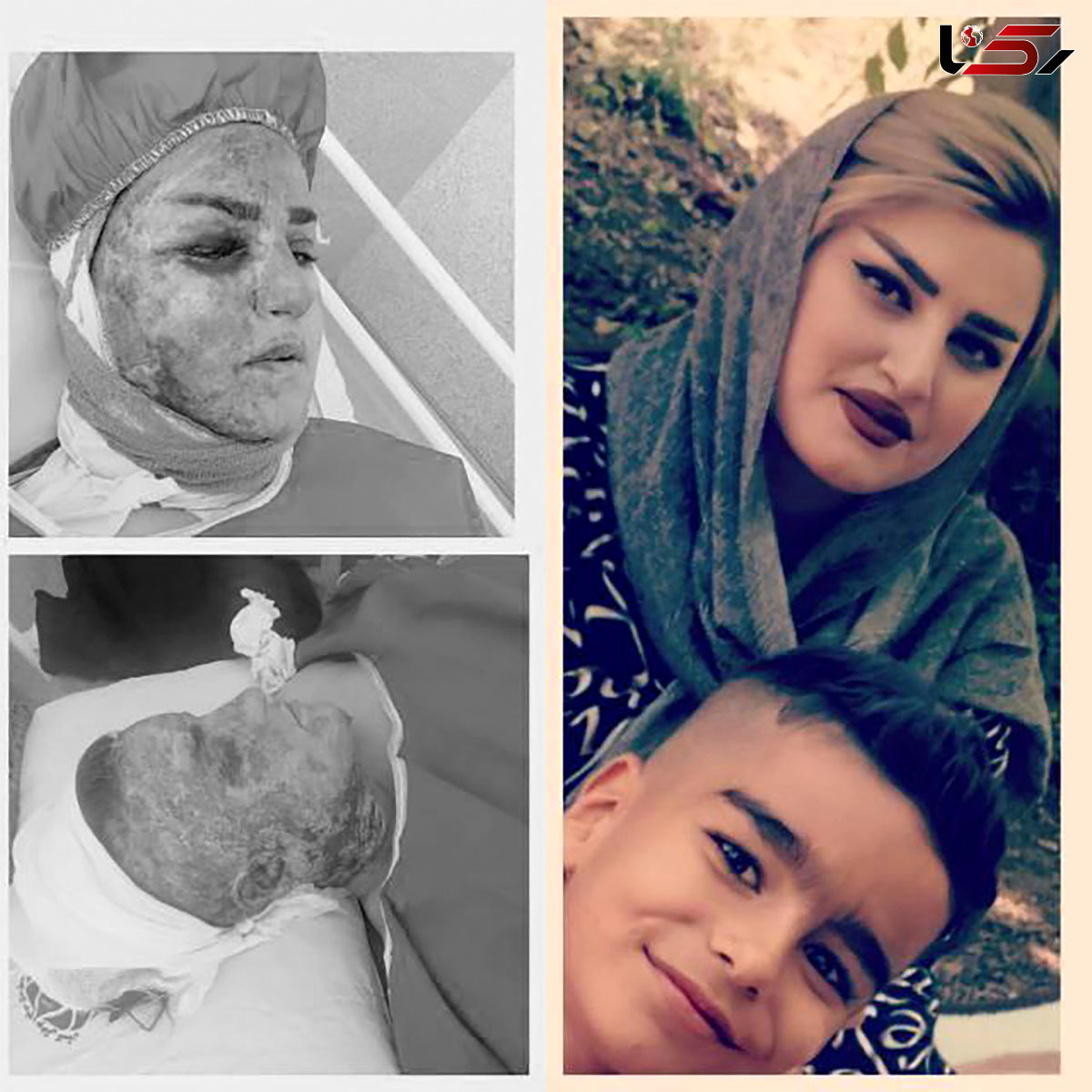 فیلم و عکس تکان دهنده از آتش سوزی نخل های منیوحی آبادان 