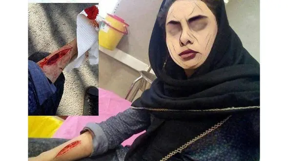 شیوع پدیده خون‌بازی در دانش‌آموزان