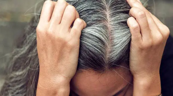 چه کنیم که موی سرمان زود سفید نشود؟