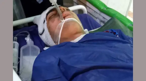  حمله خونین به یک جوان اوتیسمی در آمل + عکس