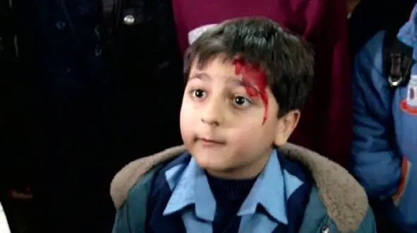 چهره جدید «محمدرضا شیرخانلو» بازیگر کودک سریال دودکش