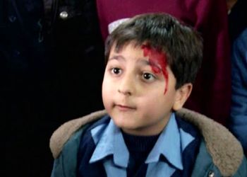 چهره جدید «محمدرضا شیرخانلو» بازیگر کودک سریال دودکش