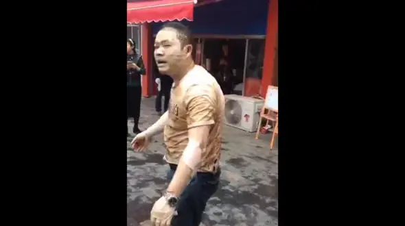 آب جوش پوست مرد چینی را کَند + فیلم (14+)