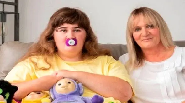 این دختر ۱۹ ساله‌ همانند نوزداد 10 ماهه زندگی می کند + تصاویر