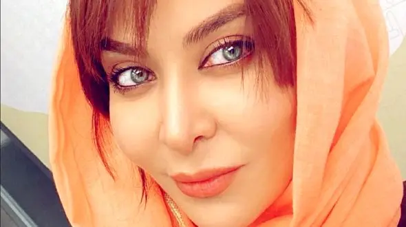  چهره ترسناک و غیرقابل باور فقیهه سلطانی قبل از عمل زیبایی / خانم بازیگر چه بود و چه شد!