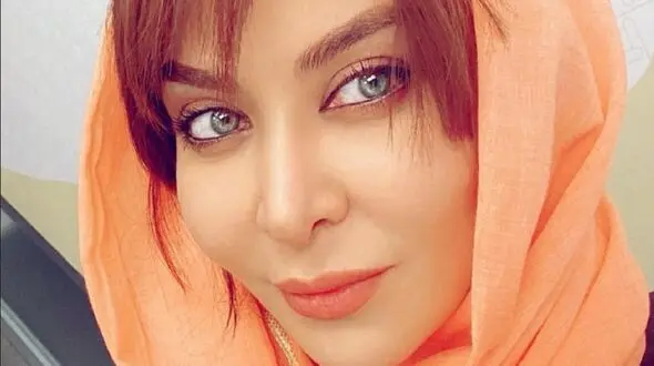  چهره ترسناک و غیرقابل باور فقیهه سلطانی قبل از عمل زیبایی / خانم بازیگر چه بود و چه شد!