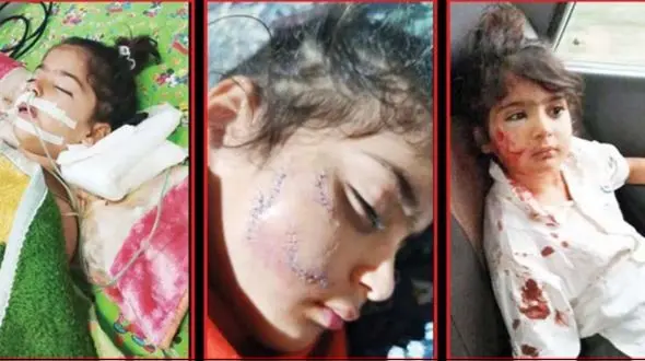 حمله مرگبار سگ ولگرد به خواهران دوقلو در نکا 