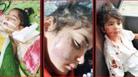 حمله مرگبار سگ ولگرد به 2 خواهر دوقلو در نکا / عسل کوچولو تسلیم مرگ شد +عکس و جزییات تلخ