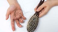 درمان ریزش مو با شیوه ای معجزه آسا