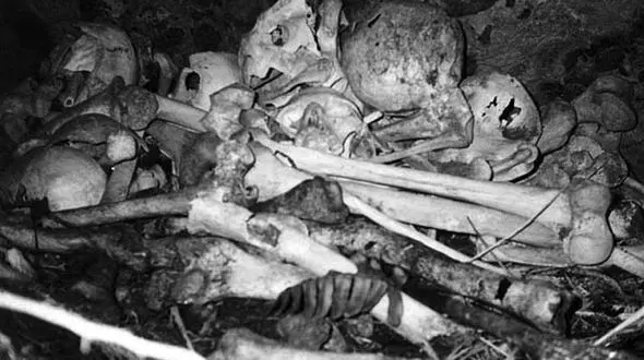 روش‌های درمانی عجیب / از خوردن گوشت انسان تا مته‌کاری جمجمه! + تصاویر