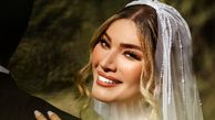 عکس /  تغییر چهره متین ستوده تازه عروس سینمای ایران قبل وبعد ازدواج با کامران تفتی  ...