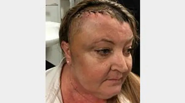 راز سردردهای این زن در تصویر ام آر آی لو رفت / در مغز او چه می گذشت؟ + عکس 