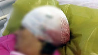 حمله خونین با داس به زن کلاردشتی / مهاجم یک مقام دولتی است + عکس