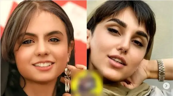 مرگ 2 خانم بازیگر جوان سریال زخم کاری ! / قرار بود عروس شوند ! + عکس هایی با لباس عروس