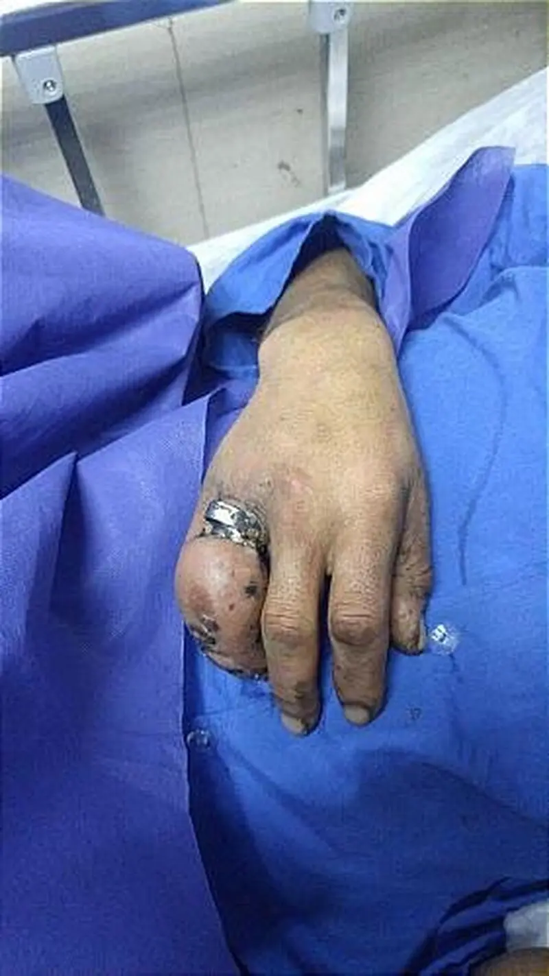 انگشتر