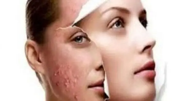 جراحی‌ گوش الاغی و چشم گربه‌ای مد جدید دختران ایرانی