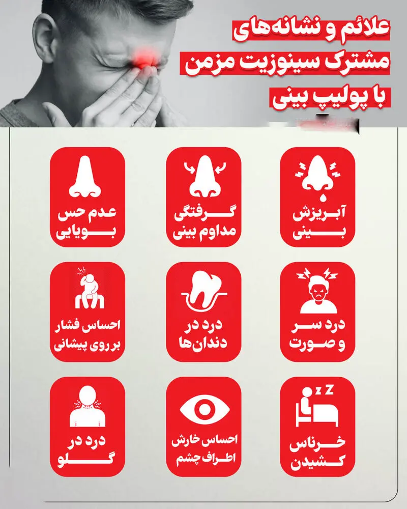 علائم سینوزیت