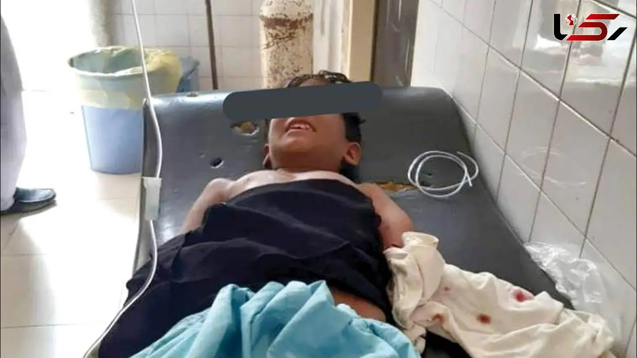 «گاندو»‌ دست‌ پسر‌ بچه‌ چابهاری‌ را‌ خورد + عکس