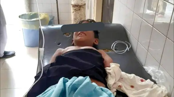 «گاندو»‌ دست‌ پسر‌ بچه‌ چابهاری‌ را‌ خورد + عکس