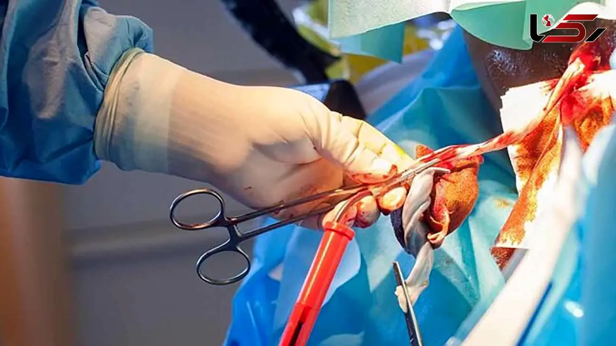 درمان سرطان‌ خون با ترکیب چند منبع خون بند ناف