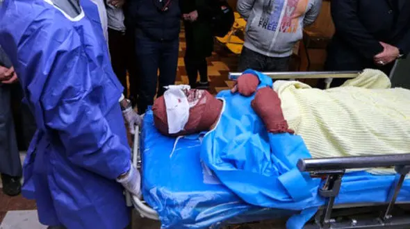 انفجار حین ساخت ترقه در آباده/ حال 2 نفر وخیم اعلام شده است