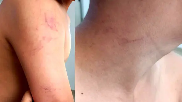 فیلم و پشت پرده کتک خوردن دانش آموز هشتگردی توسط  معلم  + اطلاعیه آموزش و پرورش