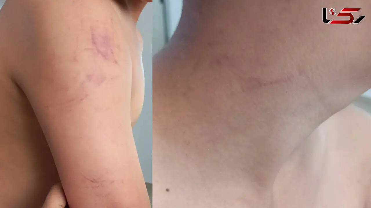 فیلم و پشت پرده کتک خوردن دانش آموز هشتگردی توسط  معلم  + اطلاعیه آموزش و پرورش
