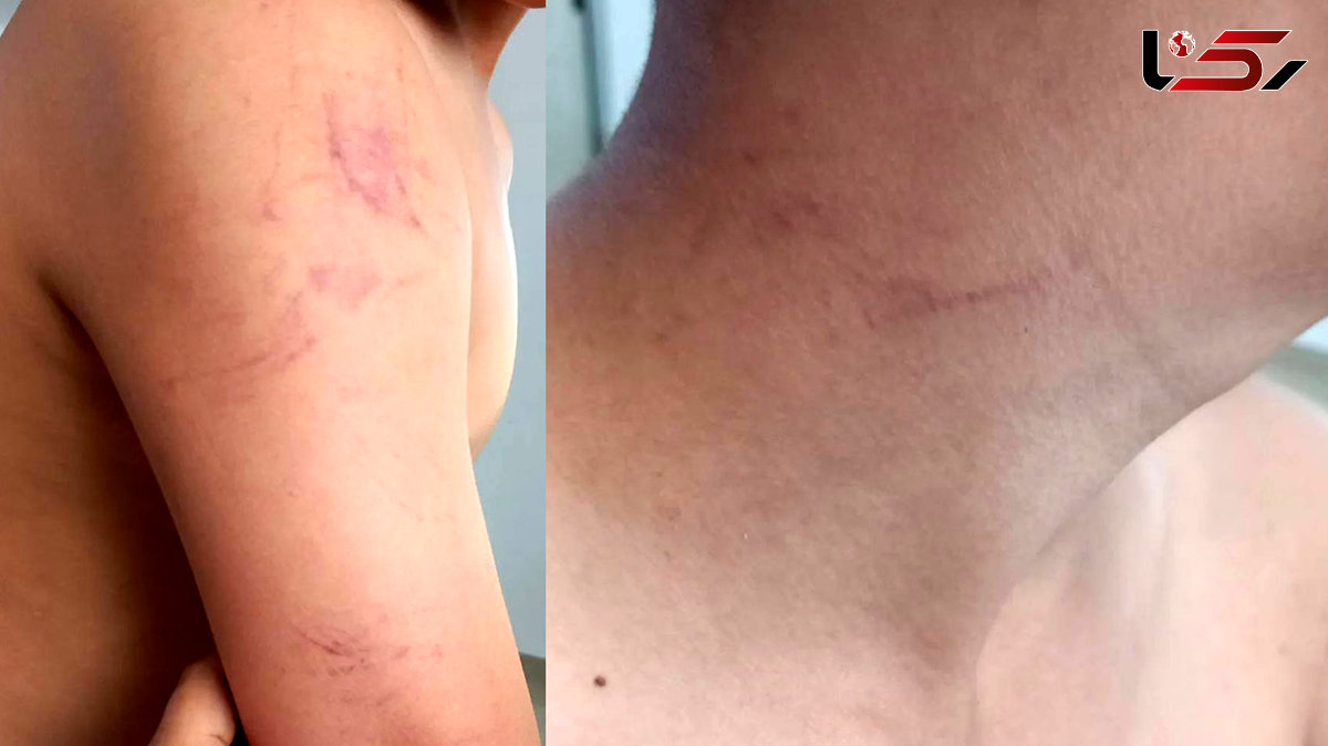 فیلم و پشت پرده کتک خوردن دانش آموز هشتگردی توسط معلم + اطلاعیه آموزش و پرورش