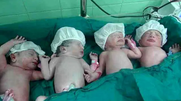 تولد نخستین چهارقلوی آبادانی