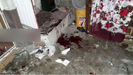 اولین حادثه وحشتناک ترقه بازی چهارشنبه سوری در بوکان / قطع پا و سوختگی شدید 4 پسر +عکس