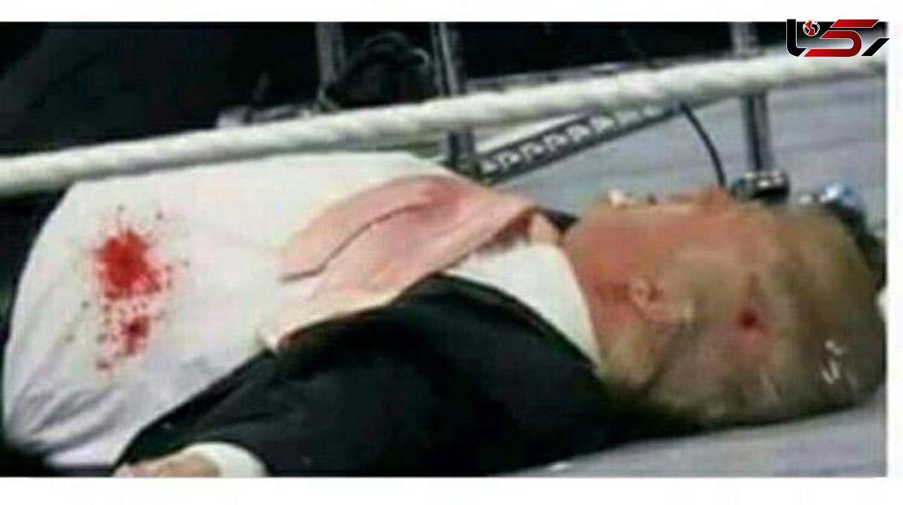  عکس جنازه ترامپ بعد از ترور / پشت پرده چیست؟