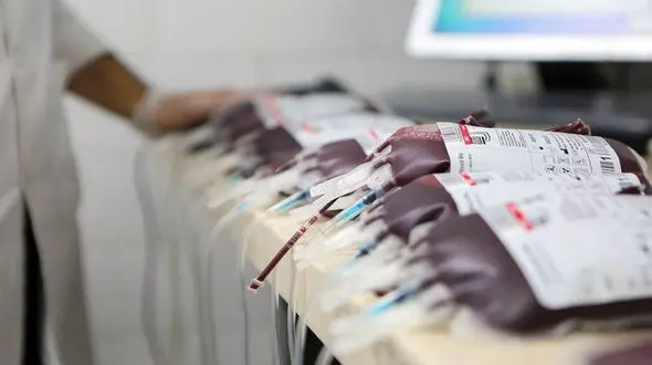 گام جدید در ایمنی خون: کیسه‌ های خونی بدون گلبول سفید برای کاهش عوارض