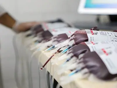 گام جدید در ایمنی خون: کیسه‌ های خونی بدون گلبول سفید برای کاهش عوارض