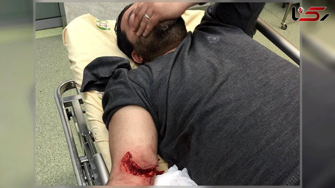 دزدان تهرانی 2 بسیجی را چاقو چاقو کردند + عکس خونین