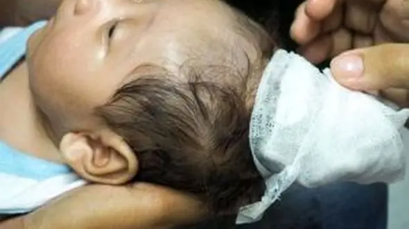 به دنیا آمدن نوزاد شاخدار سوژه رسانه ها شد+عکس