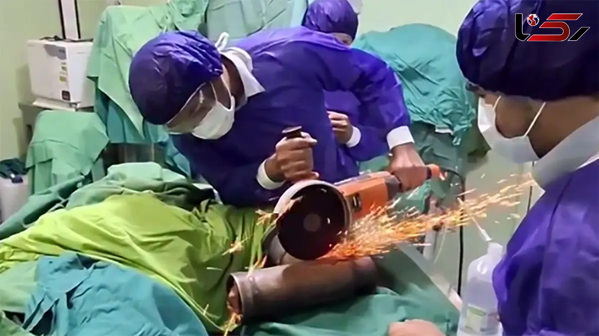 فیلم گیر کردن دست مرد جوان در چرخ گوشت / صحنه دردناک مقابل چشم آتش نشانان