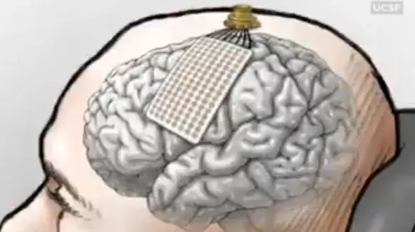 فردی که حرف نمی زد به حرف افتاد + فیلم 