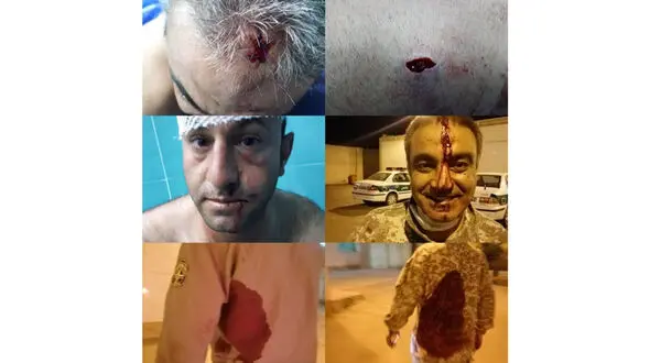 عکس 16+ / جدال خونین شکارچیان با محیط بانان خوزستان