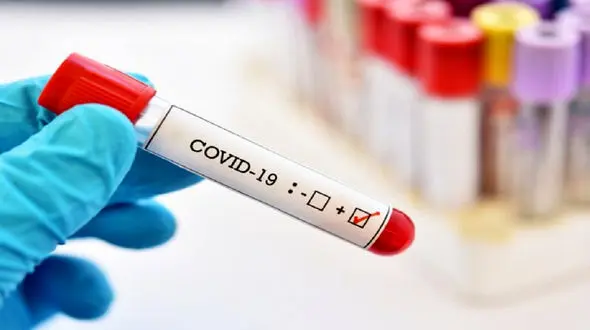 فوت 3 کرونایی در 24 ساعت گذشته در ایران / شناسایی ۳۷۱ بیمار جدید کووید۱۹ در کشور