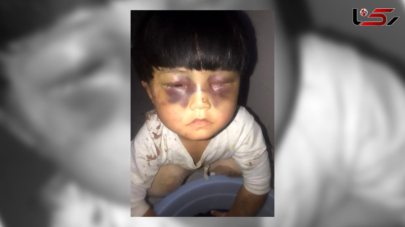 شکنجه های  بی رحمانه یک دختر در سرویس بهداشتی / عکس این دختر اشک همه را درآورد