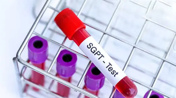 SGPT در آزمایش خون چیست؟ / جدول های مهم درباره SGPT 