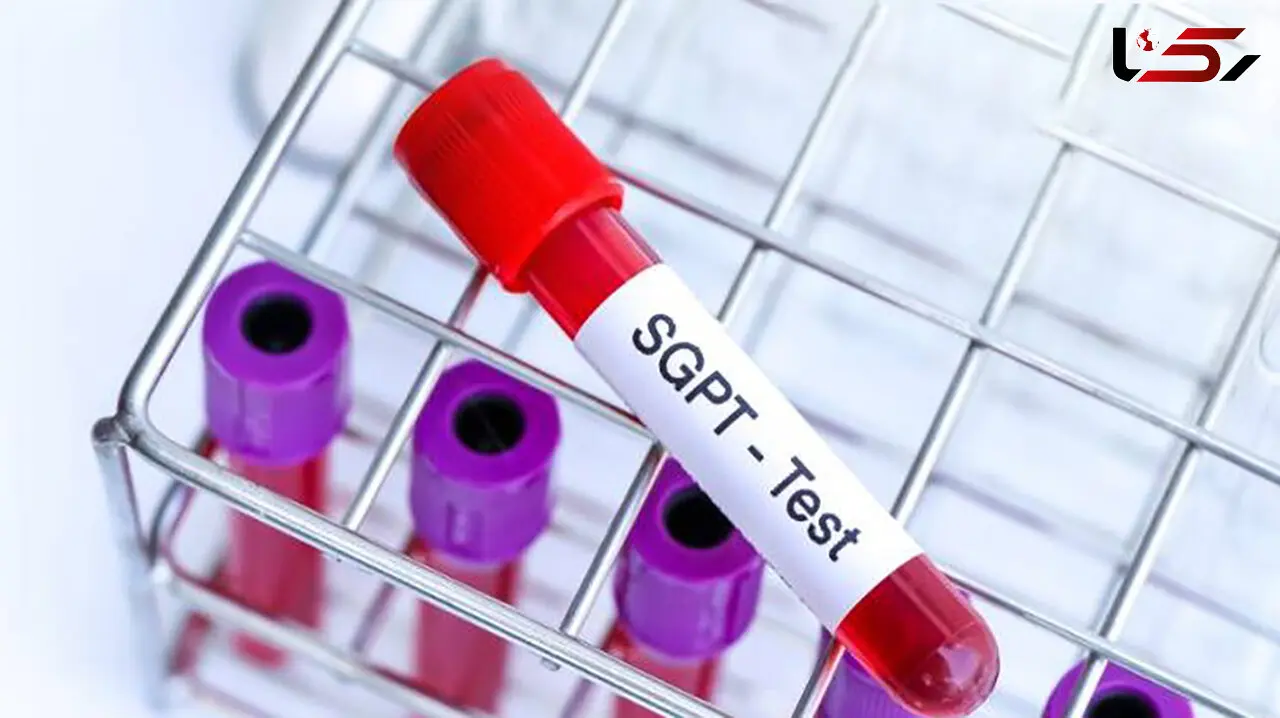 SGPT در آزمایش خون چیست؟ / جدول های مهم درباره SGPT 