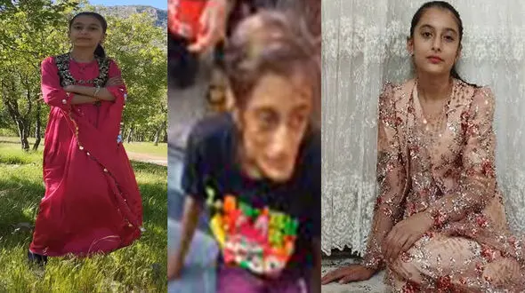 فیلم / نارین دختر نوجوان سنندجی برای دومین بار زیر تیغ جراحی رفت / یک ماه زندانی پدر و نامادری اش بود