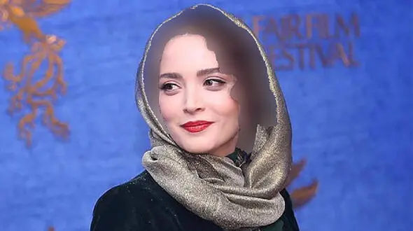 چهره کره ای بهنوش طباطبایی بعد از عمل های زیبایی ! + عکس ها را مقایسه کنید