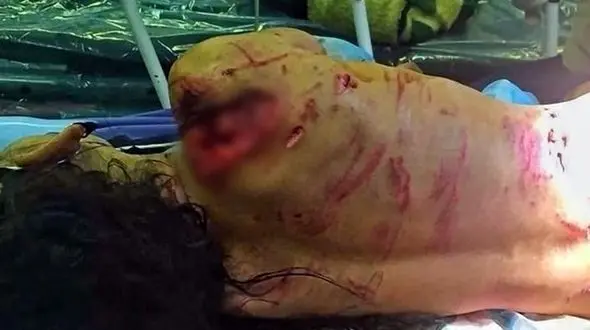 آخرین خبر از دختر گل فروش که سگ ولگرد او را دریده بود / در جنوب تهران رخ داد + عکس