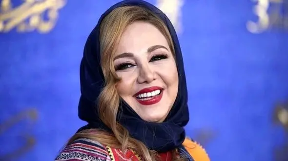 بهنوش بختیاری تغییر چهره داد ؛ خانم بازیگر قابل شناسایی نیست