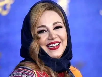 بهنوش بختیاری تغییر چهره داد ؛ خانم بازیگر قابل شناسایی نیست